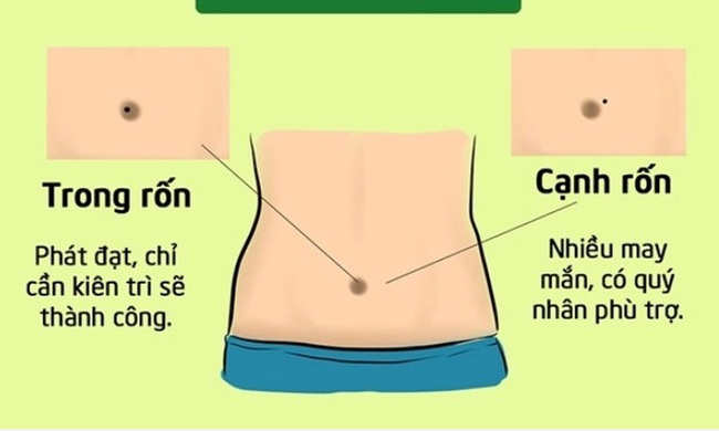 Nốt ruồi ở rốn đàn ông, phụ nữ có ý nghĩa gì?