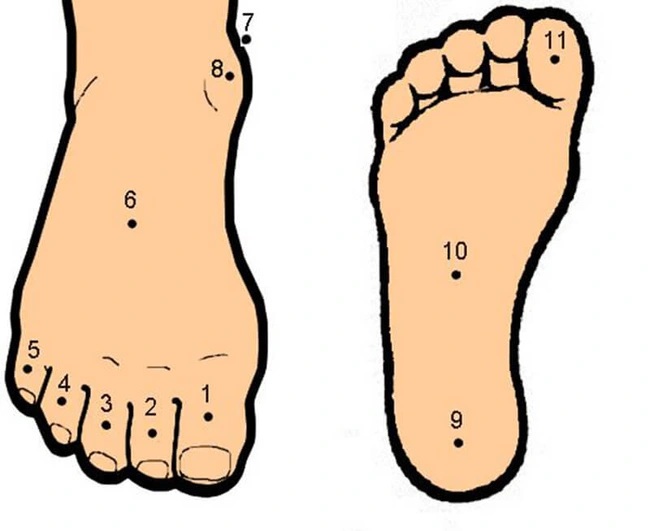 Ý nghĩa của nốt dười mọc ở bàn chân